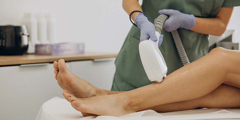 laser-epilation-hair-removal-therapy-1