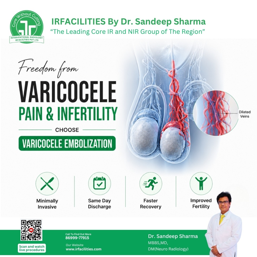 varicocele embolization (5)