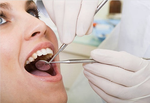 Root Canal Treatment Mount Roskill, Auckland