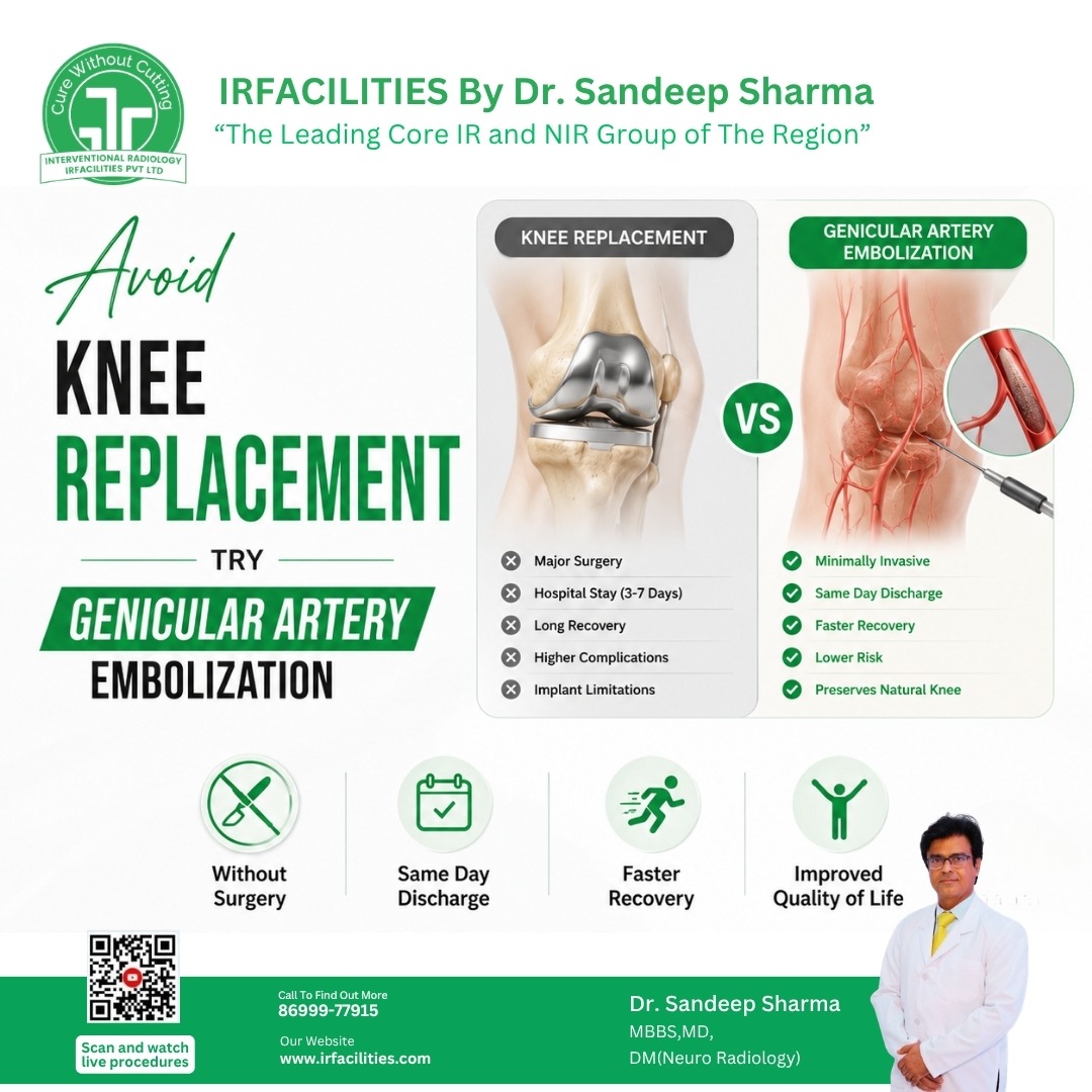 Genicular artery Treat