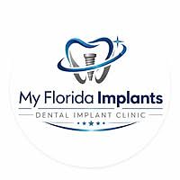 Dental Implants Jupiter