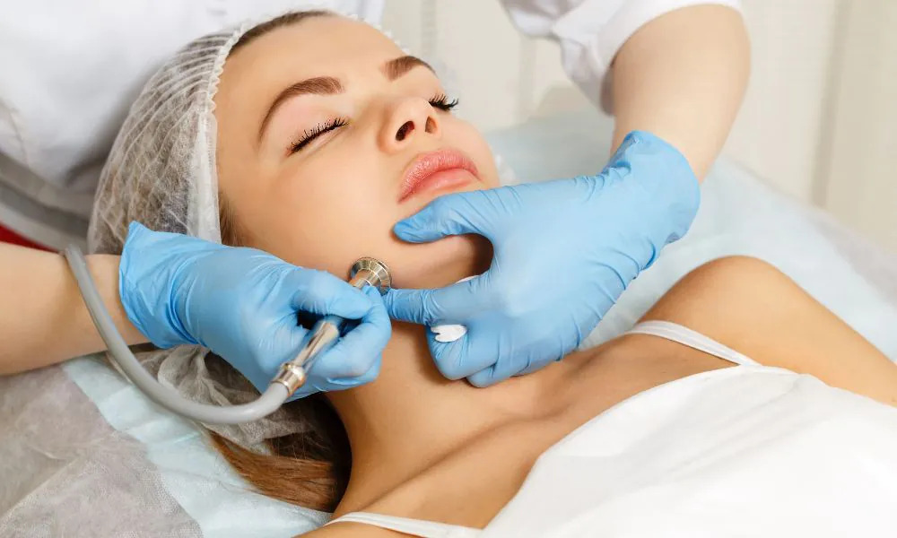 Pigmentation-Treatment-1.jpg