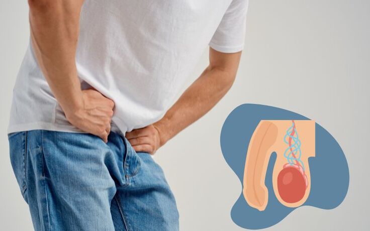 varicocele-dangerous-urology-treatment-in-haryana (1)
