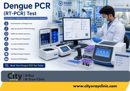 City X-Ray - Dengue PCR