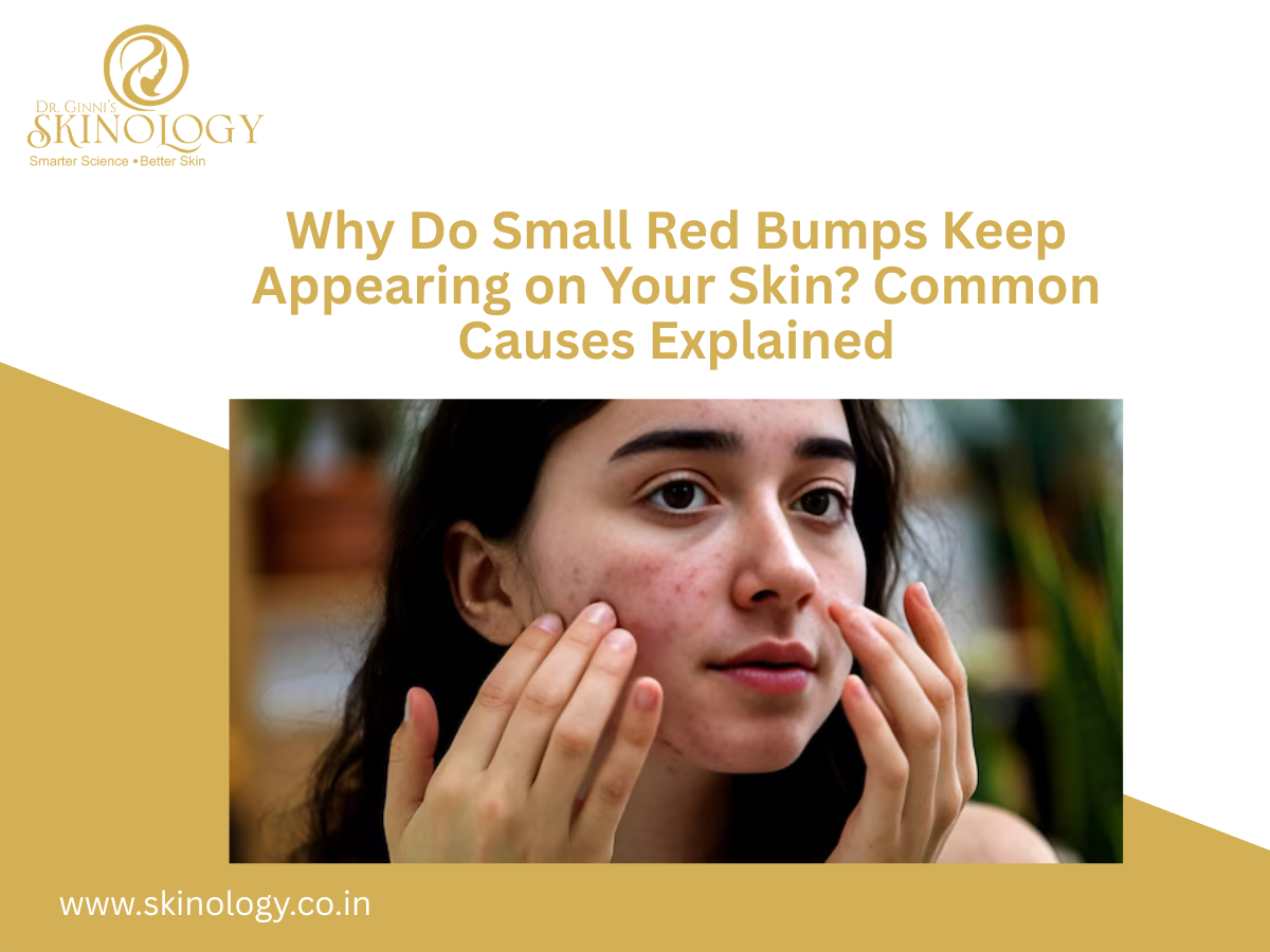 Why Do Small Red Bumps Keep Appearing on Your Skin Common Causes Explained
