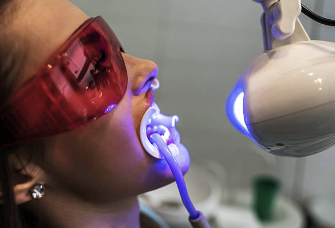 Philips Zoom Whitening in Mount Roskill