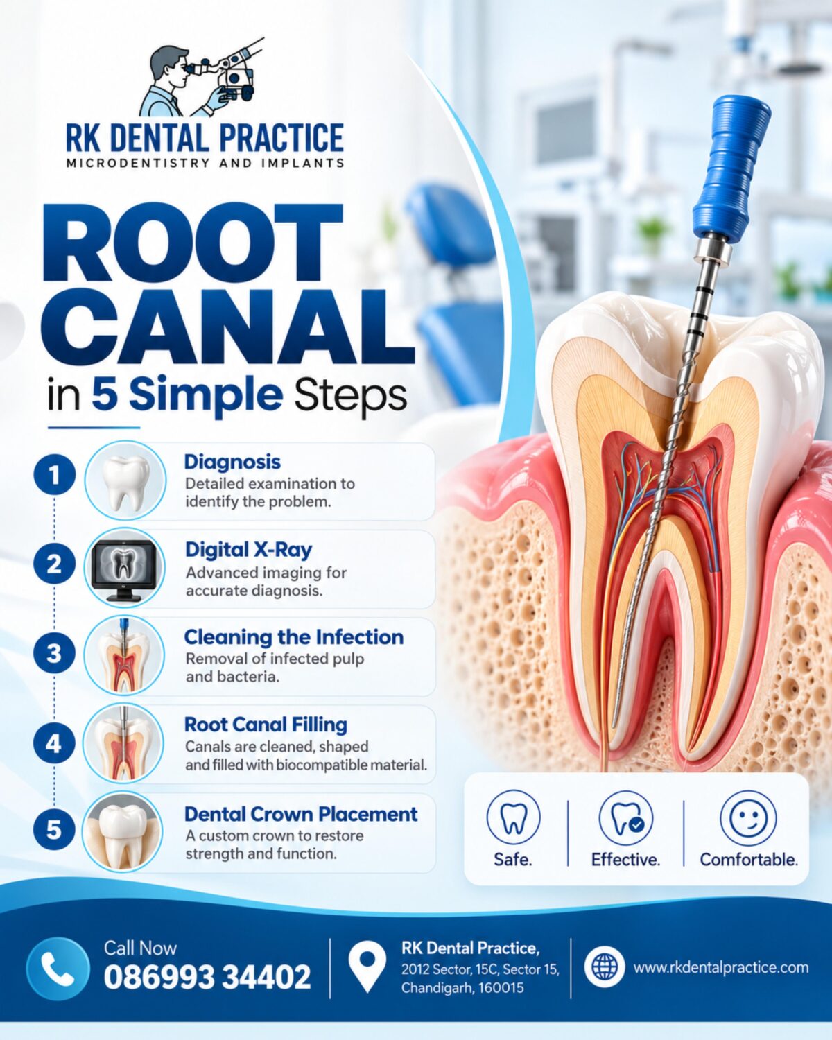imresizer-compress-Root Canal in Five Simple Steps (1)