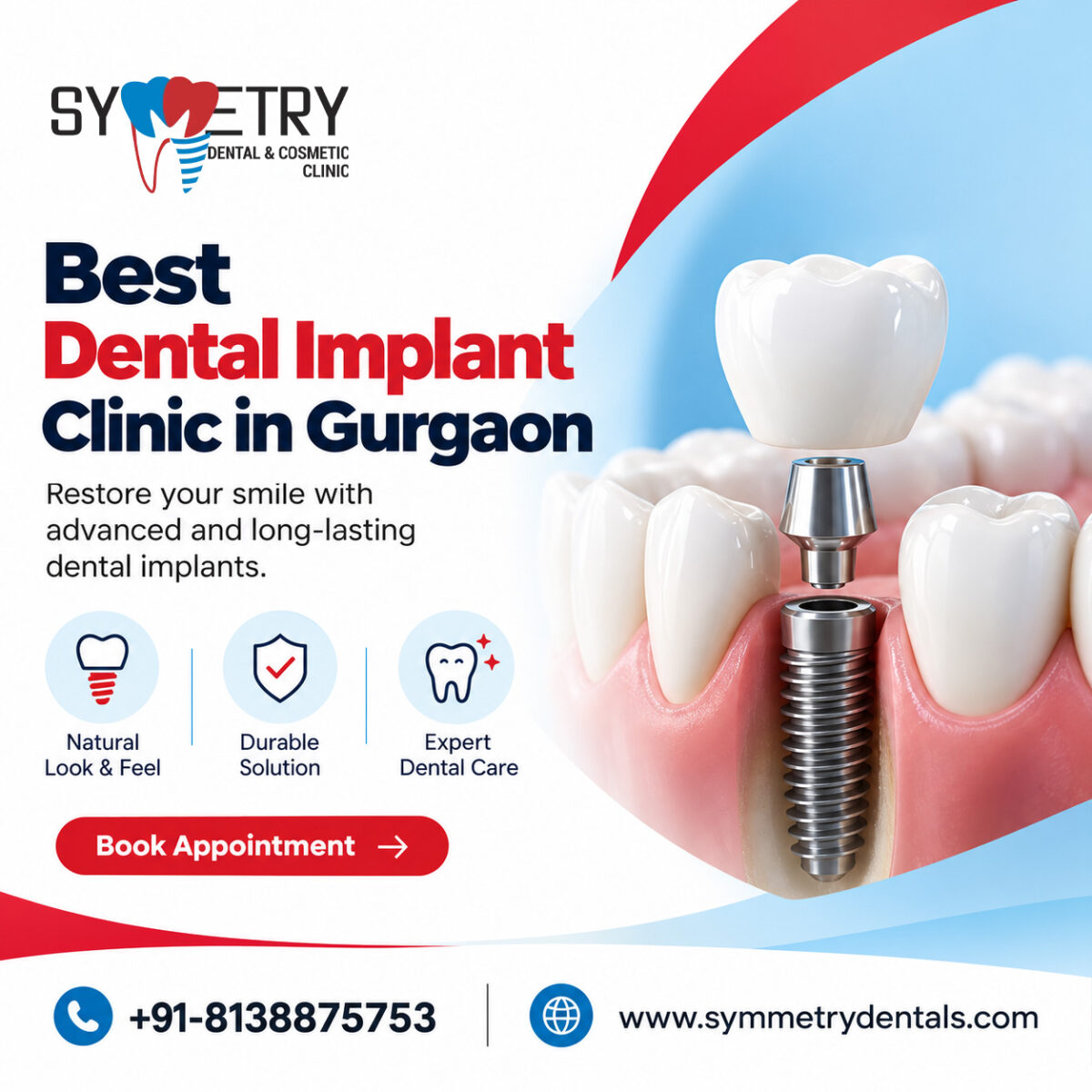 Best dental implant clinic in Gurgaon (1)