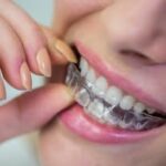 custom dentures