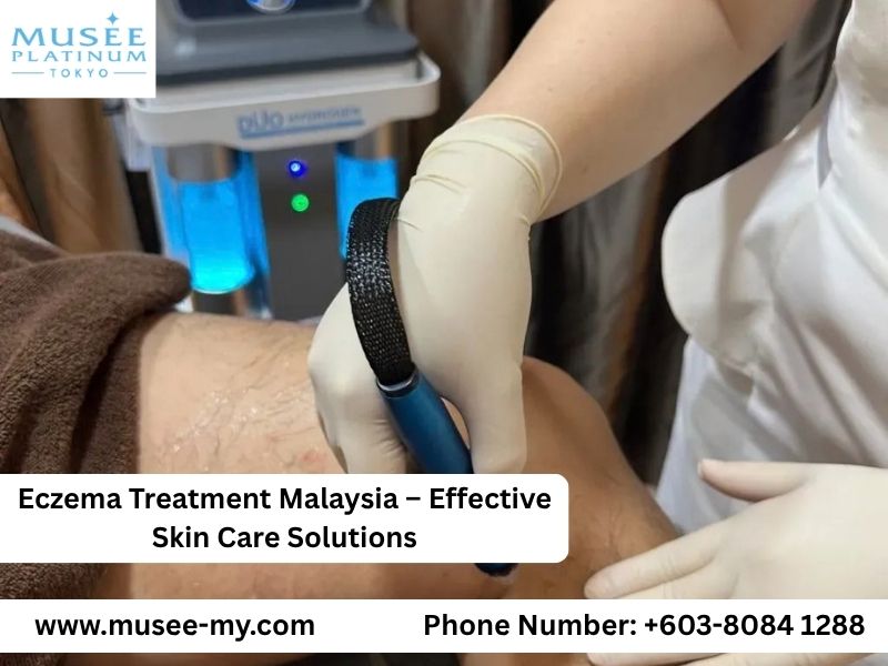 eczema treatment malaysia