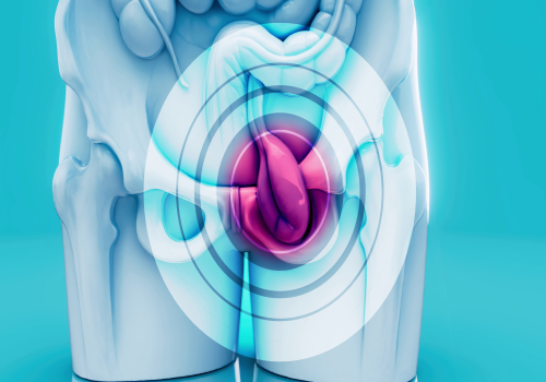 Hernia